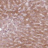 Anti-ACACB antibody produced in rabbit Prestige Antibodies&#174; Powered by Atlas Antibodies, affinity isolated antibody, buffered aqueous glycerol solution