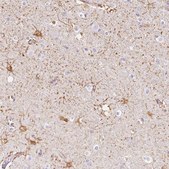 Anti-GFAP antibody produced in rabbit Prestige Antibodies® Powered by Atlas Antibodies, affinity isolated antibody, buffered aqueous glycerol solution