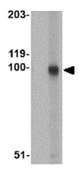 Anti-STIM2 Antibody from rabbit, purified by affinity chromatography