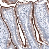 Monoclonal Anti-ACE2 antibody produced in mouse Prestige Antibodies® Powered by Atlas Antibodies, clone CL4035, purified immunoglobulin