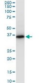 Monoclonal Anti-PRSS8 antibody produced in mouse clone 3C4, ascites fluid