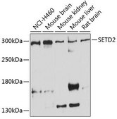 Anti-SETD2 antibody produced in rabbit
