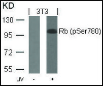 Anti-phospho-RB1 (pSer780) antibody produced in rabbit affinity isolated antibody