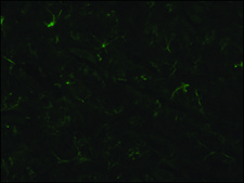 Anti-Glial Fibrillary Acidic Protein antibody, Mouse monoclonal clone G-A-5, purified from hybridoma cell culture