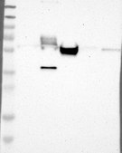 Anti-MAP2 antibody produced in rabbit Prestige Antibodies&#174; Powered by Atlas Antibodies, affinity isolated antibody, buffered aqueous glycerol solution