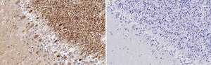 Anti-CaM Kinase II β Antibody, clone 1F13 ZooMAb® Rabbit Monoclonal recombinant, expressed in HEK 293 cells