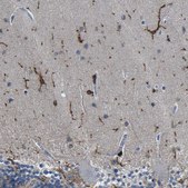 Anti-P2RY12 antibody produced in rabbit Prestige Antibodies&#174; Powered by Atlas Antibodies, affinity isolated antibody, buffered aqueous glycerol solution