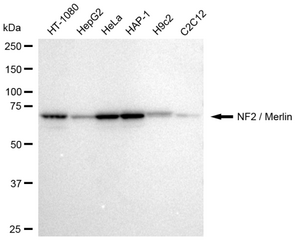 KD-Validated Anti NF2 / Merlin Antibody, clone 23GB2620, Rabbit Monoclonal clone 23GB2620, recombinant rabbit monoclonal, expressed in HEK293 cells