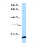 Anti-ARF6 antibody produced in rabbit affinity isolated antibody