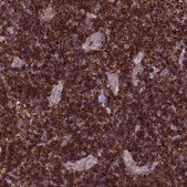 Anti-ARHGEF18 antibody produced in rabbit Prestige Antibodies&#174; Powered by Atlas Antibodies, affinity isolated antibody, buffered aqueous glycerol solution