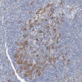 Anti-CDK1 antibody produced in rabbit Prestige Antibodies® Powered by Atlas Antibodies, affinity isolated antibody, buffered aqueous glycerol solution