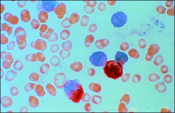 Leukocyte Naphthol AS-D Chloroacetate (Specific Esterase) Kit