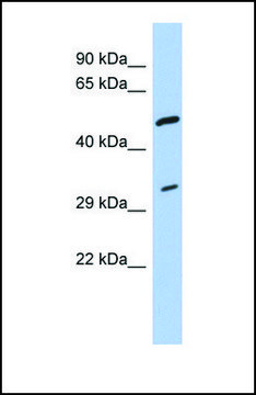 Anti-TPM3 antibody produced in rabbit affinity isolated antibody