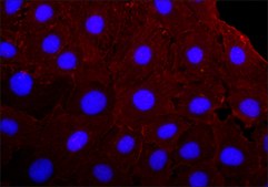 Anti-&#947;-Actin antibody, Mouse monoclonal clone 2-2.1.14.17, purified from hybridoma cell culture