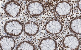 Anti-HMGA1 Antibody, clone 1F20 ZooMAb&#174; Rabbit Monoclonal recombinant, expressed in HEK 293 cells