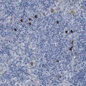 Anti-ALOX15 antibody produced in rabbit Prestige Antibodies&#174; Powered by Atlas Antibodies, affinity isolated antibody, buffered aqueous glycerol solution