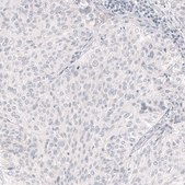 Monoclonal Anti-NANOG antibody produced in mouse Prestige Antibodies&#174; Powered by Atlas Antibodies, clone CL5803, purified immunoglobulin, buffered aqueous glycerol solution