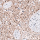 Monoclonal Anti-TH antibody produced in mouse Prestige Antibodies&#174; Powered by Atlas Antibodies, clone CL3049, purified immunoglobulin, buffered aqueous glycerol solution