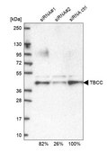 Anti-TBCC antibody produced in rabbit Prestige Antibodies&#174; Powered by Atlas Antibodies, affinity isolated antibody, buffered aqueous glycerol solution