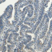 Anti-CTSD antibody produced in rabbit Prestige Antibodies&#174; Powered by Atlas Antibodies, affinity isolated antibody, buffered aqueous glycerol solution