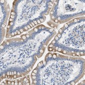 Anti-TEX264 antibody produced in rabbit Prestige Antibodies&#174; Powered by Atlas Antibodies, affinity isolated antibody, buffered aqueous glycerol solution