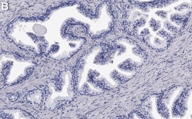 Anti-ATF3 Antibody, clone 1G12 ZooMAb&#174; Rabbit Monoclonal recombinant, expressed in HEK 293 cells