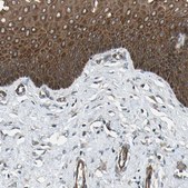 Anti-FLII antibody produced in rabbit Prestige Antibodies&#174; Powered by Atlas Antibodies, affinity isolated antibody, buffered aqueous glycerol solution