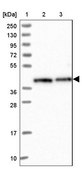 Anti-RBM4 antibody produced in rabbit Prestige Antibodies&#174; Powered by Atlas Antibodies, affinity isolated antibody, buffered aqueous glycerol solution