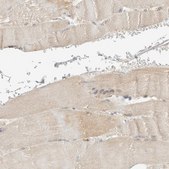 Anti-RAB11FIP1 antibody produced in rabbit Prestige Antibodies&#174; Powered by Atlas Antibodies, affinity isolated antibody, buffered aqueous glycerol solution, Ab2