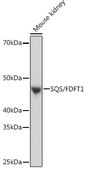 Anti-SQS/FDFT1 Antibody, clone 4W10J4, Rabbit Monoclonal