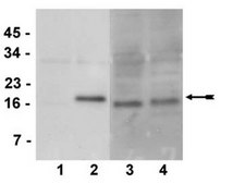 Anti-phospho-CENP-A (Ser7) Antibody, clone NL41, rabbit monoclonal culture supernatant, clone NL41, Upstate&#174;