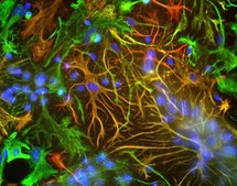 Anti-Vimentin Antibody serum, Chemicon&#174;