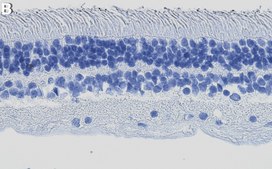 Anti-Arrestin-C Antibody, clone 1I3 ZooMAb&#174; Rabbit Monoclonal recombinant, expressed in HEK 293 cells
