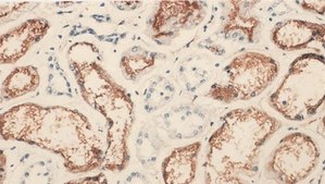 Anti-Angiotensin Converting Enzyme Antibody, clone 9B9 clone 9B9, Chemicon&#174;, from mouse