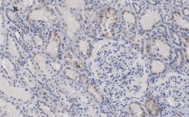 Anti-c-Myc Antibody, clone 7E18, ZooMAb&#174; Rabbit Monoclonal recombinant, expressed in HEK 293 cells