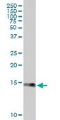 Monoclonal Anti-S100A9 antibody produced in mouse clone 4G9, purified immunoglobulin, buffered aqueous solution