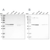 Anti-CNP antibody produced in rabbit Prestige Antibodies&#174; Powered by Atlas Antibodies, affinity isolated antibody, buffered aqueous glycerol solution, Ab2