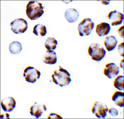 Anti-TRPC6 (ab2) antibody produced in rabbit affinity isolated antibody, buffered aqueous solution