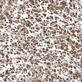 Monoclonal Anti-PIK3CA antibody produced in mouse Prestige Antibodies&#174; Powered by Atlas Antibodies, clone CL8347, purified immunoglobulin, buffered aqueous glycerol solution