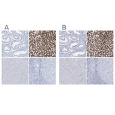 Anti-AGXT antibody produced in rabbit Prestige Antibodies&#174; Powered by Atlas Antibodies, affinity isolated antibody, buffered aqueous glycerol solution
