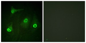 Anti-NF-κB p65 (Acetyl-Lys310) antibody produced in rabbit affinity isolated antibody