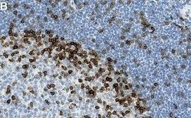 Anti-LAT Antibody, clone 2B4 ZooMAb&#174; Rabbit Monoclonal recombinant, expressed in HEK 293 cells