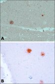 Anti-&#946;-Amyloid antibody, Mouse monoclonal clone BAM-10, ascites fluid