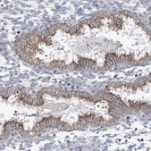 Anti-AGPS antibody produced in rabbit Prestige Antibodies&#174; Powered by Atlas Antibodies, affinity isolated antibody, buffered aqueous glycerol solution, ab3