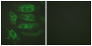 Anti-Adrenergic Receptor &#946;2 antibody produced in rabbit affinity isolated antibody