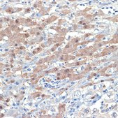 [KO Validated]Anti-Smad4 Antibody, clone 1H7D3, Rabbit Monoclonal