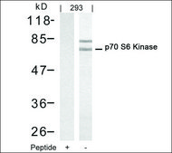 Anti-RPS6KB1 (Ab-421) antibody produced in rabbit affinity isolated antibody