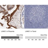 Anti-LAMC1 antibody produced in rabbit Ab2, Prestige Antibodies&#174; Powered by Atlas Antibodies, affinity isolated antibody, buffered aqueous glycerol solution