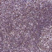 Monoclonal Anti-REST antibody produced in mouse Prestige Antibodies&#174; Powered by Atlas Antibodies, clone CL0381, purified immunoglobulin, buffered aqueous glycerol solution