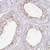 Anti-MTTP antibody produced in rabbit Prestige Antibodies&#174; Powered by Atlas Antibodies, affinity isolated antibody, buffered aqueous glycerol solution
